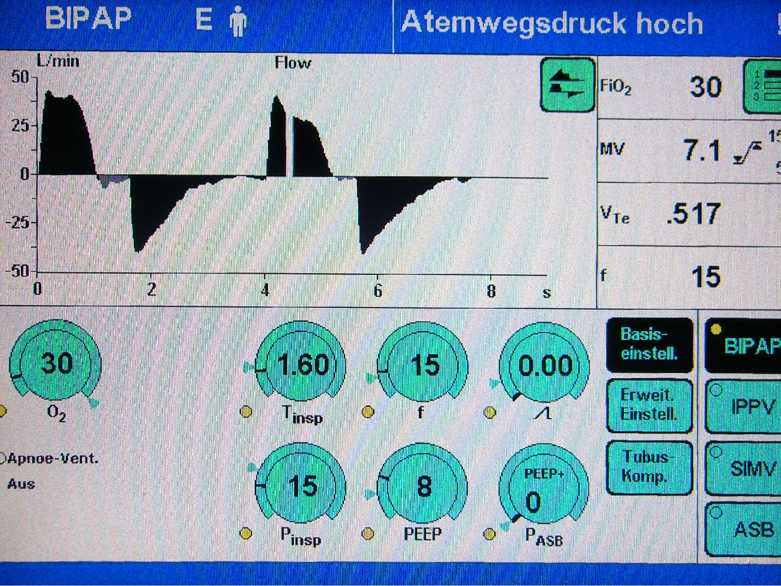 atmung-beatmung-dirk-jahnke-von-flow-und-druck